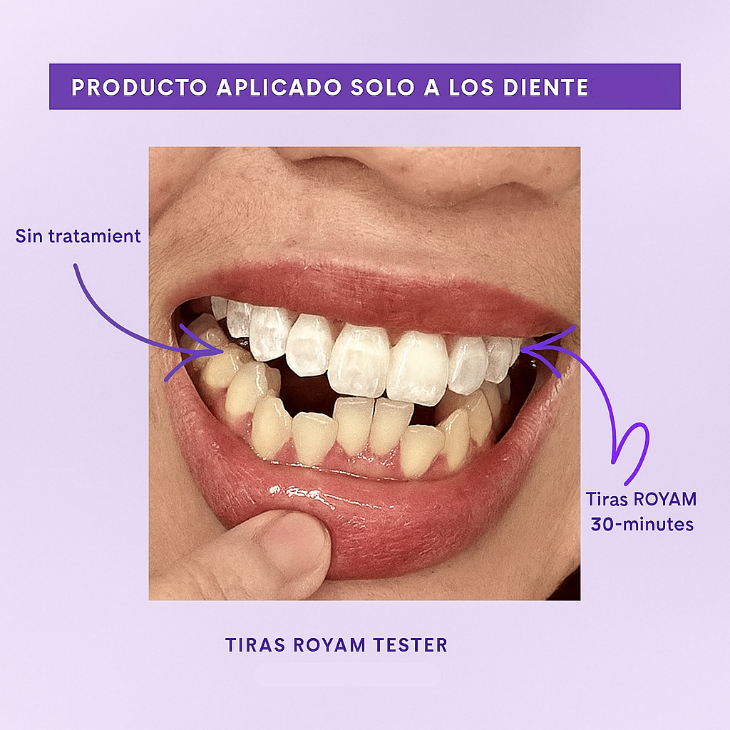 Tiras blanqueadoras V34