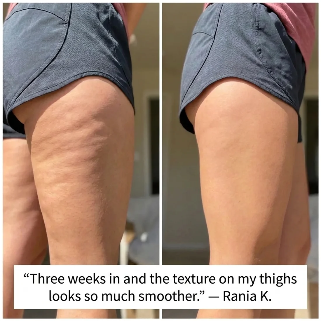 RESTORA™ Nightly Reset Roller — Body care worth coming back to