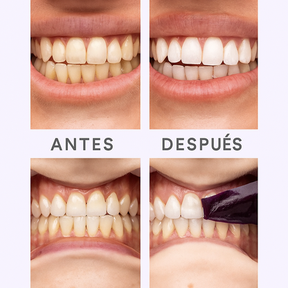 Tiras blanqueadoras V34